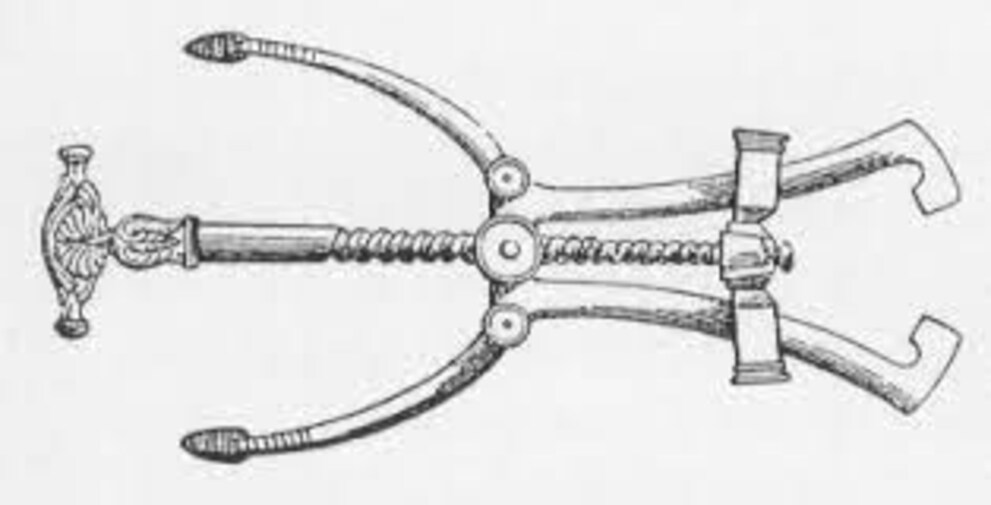 Sieht ein bisschen aus wie ein Korkenzieher, ist aber ein Spekulum. Bild: hp-gramatke.de