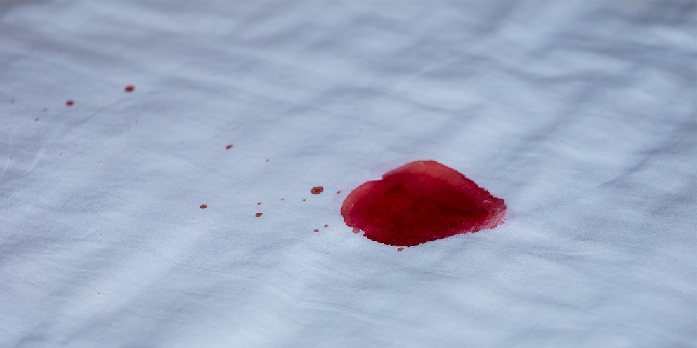 Blutflecken sind vor allem auf hellen Materialien ein grosses Problem.