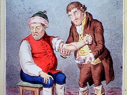 Aderlass im Mittelalter. Bild: history.com