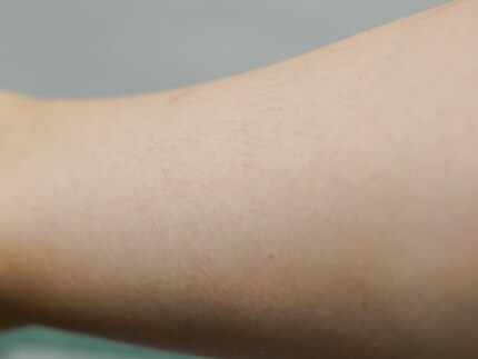 How my skin looked before…