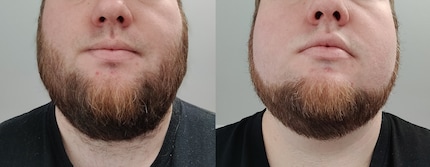 Ein Vorher-Nachher-Vergleich: Es sieht nicht perfekt aus. Ich musste vorne links nochmal nacharbeiten, aber ich bin zufrieden.
