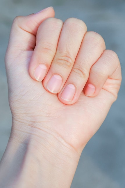 Some have them on all fingers…