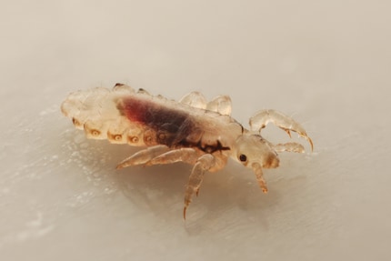 The reddish colour gives it away: This head louse has just sucked blood.