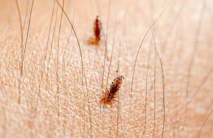 The louse sucks blood from the scalp approximately every five hours.
